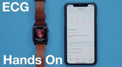 Działanie EKG na Apple Watchu